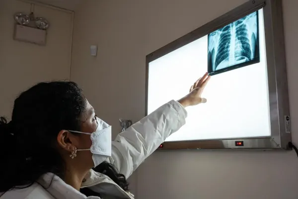 A clinician reviews the chest X-ray of a patient participating in the endTB clinical trial in Peru. 