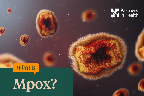 Mpox Graphic