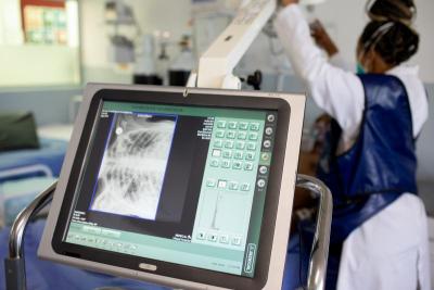 MDR-TB patient Khamokha Khamokha is seen by an x-ray radiographer.