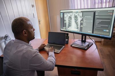 A man sits at a wood desk with a laptop, looking at a chest x-ray on a larger screen beside it.