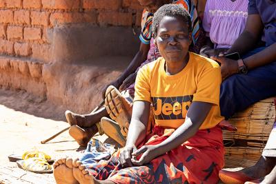 Vitalina Chaona and her family share moments together during a medical home visit at their residence in Ntcheu following a successful heart surgery in Tanzania.