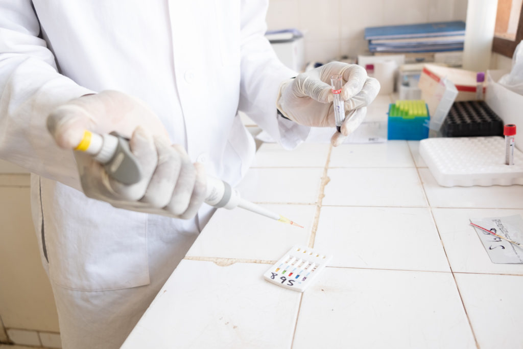 A laboratory technician conducts a blood test for hepatitis B at PIH-supported Koidu Government Hospital in Kono District, Sierra Leone.